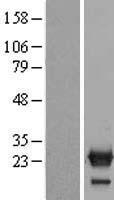 Western blot validation of overexpression lysate (Cat# LY412893) using anti-DDK antibody (Cat# TA50011-100). Left: Cell lysates from un-transfected HEK293T cells; Right: Cell lysates from HEK293T cells transfected with RC213204 using transfection reagent MegaTran 2.0 (Cat# TT210002).
