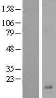 Western blot validation of overexpression lysate (Cat# LY404255) using anti-DDK antibody (Cat# TA50011-100). Left: Cell lysates from un-transfected HEK293T cells; Right: Cell lysates from HEK293T cells transfected with RC214703 using transfection reagent MegaTran 2.0 (Cat# TT210002).