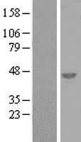 Western blot validation of overexpression lysate (Cat# LY407462) using anti-DDK antibody (Cat# TA50011-100). Left: Cell lysates from un-transfected HEK293T cells; Right: Cell lysates from HEK293T cells transfected with RC212521 using transfection reagent MegaTran 2.0 (Cat# TT210002).