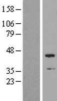 Western blot validation of overexpression lysate (Cat# LY409608) using anti-DDK antibody (Cat# TA50011-100). Left: Cell lysates from un-transfected HEK293T cells; Right: Cell lysates from HEK293T cells transfected with RC222981 using transfection reagent MegaTran 2.0 (Cat# TT210002).