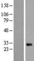 Western blot validation of overexpression lysate (Cat# LY415615) using anti-DDK antibody (Cat# TA50011-100). Left: Cell lysates from un-transfected HEK293T cells; Right: Cell lysates from HEK293T cells transfected with RC223922 using transfection reagent MegaTran 2.0 (Cat# TT210002).