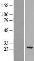 Western blot validation of overexpression lysate (Cat# LY415352) using anti-DDK antibody (Cat# TA50011-100). Left: Cell lysates from un-transfected HEK293T cells; Right: Cell lysates from HEK293T cells transfected with RC223009 using transfection reagent MegaTran 2.0 (Cat# TT210002).