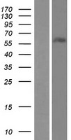 Western blot validation of overexpression lysate (Cat# LY404940) using anti-DDK antibody (Cat# TA50011-100). Left: Cell lysates from un-transfected HEK293T cells; Right: Cell lysates from HEK293T cells transfected with RC211416 using transfection reagent MegaTran 2.0 (Cat# TT210002).