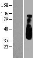 Western blot validation of overexpression lysate (Cat# LY413559) using anti-DDK antibody (Cat# TA50011-100). Left: Cell lysates from un-transfected HEK293T cells; Right: Cell lysates from HEK293T cells transfected with RC221954 using transfection reagent MegaTran 2.0 (Cat# TT210002).