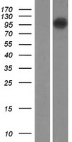 Western blot validation of overexpression lysate (Cat# LY409912) using anti-DDK antibody (Cat# TA50011-100). Left: Cell lysates from un-transfected HEK293T cells; Right: Cell lysates from HEK293T cells transfected with RC218116 using transfection reagent MegaTran 2.0 (Cat# TT210002).