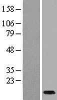 Western blot validation of overexpression lysate (Cat# LY407914) using anti-DDK antibody (Cat# TA50011-100). Left: Cell lysates from un-transfected HEK293T cells; Right: Cell lysates from HEK293T cells transfected with RC217663 using transfection reagent MegaTran 2.0 (Cat# TT210002).