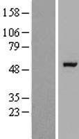 Western blot validation of overexpression lysate (Cat# LY414035) using anti-DDK antibody (Cat# TA50011-100). Left: Cell lysates from un-transfected HEK293T cells; Right: Cell lysates from HEK293T cells transfected with RC215151 using transfection reagent MegaTran 2.0 (Cat# TT210002).