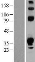 Western blot validation of overexpression lysate (Cat# LY404574) using anti-DDK antibody (Cat# TA50011-100). Left: Cell lysates from un-transfected HEK293T cells; Right: Cell lysates from HEK293T cells transfected with RC215088 using transfection reagent MegaTran 2.0 (Cat# TT210002).