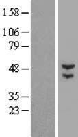 Western blot validation of overexpression lysate (Cat# LY405759) using anti-DDK antibody (Cat# TA50011-100). Left: Cell lysates from un-transfected HEK293T cells; Right: Cell lysates from HEK293T cells transfected with RC223754 using transfection reagent MegaTran 2.0 (Cat# TT210002).