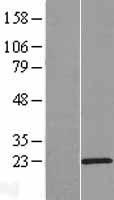 Western blot validation of overexpression lysate (Cat# LY407175) using anti-DDK antibody (Cat# TA50011-100). Left: Cell lysates from un-transfected HEK293T cells; Right: Cell lysates from HEK293T cells transfected with RC218523 using transfection reagent MegaTran 2.0 (Cat# TT210002).