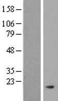 Western blot validation of overexpression lysate (Cat# LY409349) using anti-DDK antibody (Cat# TA50011-100). Left: Cell lysates from un-transfected HEK293T cells; Right: Cell lysates from HEK293T cells transfected with RC214678 using transfection reagent MegaTran 2.0 (Cat# TT210002).