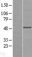 Western blot validation of overexpression lysate (Cat# LY406553) using anti-DDK antibody (Cat# TA50011-100). Left: Cell lysates from un-transfected HEK293T cells; Right: Cell lysates from HEK293T cells transfected with RC218871 using transfection reagent MegaTran 2.0 (Cat# TT210002).