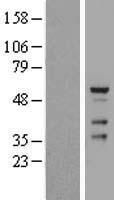 Western blot validation of overexpression lysate (Cat# LY407592) using anti-DDK antibody (Cat# TA50011-100). Left: Cell lysates from un-transfected HEK293T cells; Right: Cell lysates from HEK293T cells transfected with RC213155 using transfection reagent MegaTran 2.0 (Cat# TT210002).