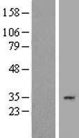 Western blot validation of overexpression lysate (Cat# LY410430) using anti-DDK antibody (Cat# TA50011-100). Left: Cell lysates from un-transfected HEK293T cells; Right: Cell lysates from HEK293T cells transfected with RC216474 using transfection reagent MegaTran 2.0 (Cat# TT210002).