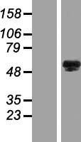 Western blot validation of overexpression lysate (Cat# LY421821) using anti-DDK antibody (Cat# TA50011-100). Left: Cell lysates from un-transfected HEK293T cells; Right: Cell lysates from HEK293T cells transfected with RC218717 using transfection reagent MegaTran 2.0 (Cat# TT210002).