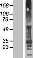 Western blot validation of overexpression lysate (Cat# LY422998) using anti-DDK antibody (Cat# TA50011-100). Left: Cell lysates from un-transfected HEK293T cells; Right: Cell lysates from HEK293T cells transfected with RC216659 using transfection reagent MegaTran 2.0 (Cat# TT210002).