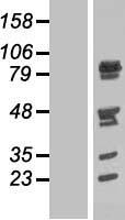 Western blot validation of overexpression lysate (Cat# LY412327) using anti-DDK antibody (Cat# TA50011-100). Left: Cell lysates from un-transfected HEK293T cells; Right: Cell lysates from HEK293T cells transfected with RC223723 using transfection reagent MegaTran 2.0 (Cat# TT210002).