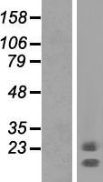 Western blot validation of overexpression lysate (Cat# LY423253) using anti-DDK antibody (Cat# TA50011-100). Left: Cell lysates from un-transfected HEK293T cells; Right: Cell lysates from HEK293T cells transfected with RC221481 using transfection reagent MegaTran 2.0 (Cat# TT210002).