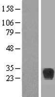 Western blot validation of overexpression lysate (Cat# LY417303) using anti-DDK antibody (Cat# TA50011-100). Left: Cell lysates from un-transfected HEK293T cells; Right: Cell lysates from HEK293T cells transfected with RC221840 using transfection reagent MegaTran 2.0 (Cat# TT210002).