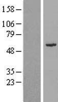 Western blot validation of overexpression lysate (Cat# LY406222) using anti-DDK antibody (Cat# TA50011-100). Left: Cell lysates from un-transfected HEK293T cells; Right: Cell lysates from HEK293T cells transfected with RC215463 using transfection reagent MegaTran 2.0 (Cat# TT210002).