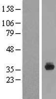 Western blot validation of overexpression lysate (Cat# LY422845) using anti-DDK antibody (Cat# TA50011-100). Left: Cell lysates from un-transfected HEK293T cells; Right: Cell lysates from HEK293T cells transfected with RC214332 using transfection reagent MegaTran 2.0 (Cat# TT210002).