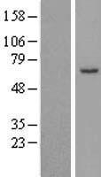 Western blot validation of overexpression lysate (Cat# LY423169) using anti-DDK antibody (Cat# TA50011-100). Left: Cell lysates from un-transfected HEK293T cells; Right: Cell lysates from HEK293T cells transfected with RC212752 using transfection reagent MegaTran 2.0 (Cat# TT210002).