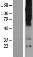 Western blot validation of overexpression lysate (Cat# LY413795) using anti-DDK antibody (Cat# TA50011-100). Left: Cell lysates from un-transfected HEK293T cells; Right: Cell lysates from HEK293T cells transfected with RC222288 using transfection reagent MegaTran 2.0 (Cat# TT210002).