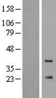 Western blot validation of overexpression lysate (Cat# LY417298) using anti-DDK antibody (Cat# TA50011-100). Left: Cell lysates from un-transfected HEK293T cells; Right: Cell lysates from HEK293T cells transfected with RC216167 using transfection reagent MegaTran 2.0 (Cat# TT210002).