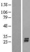 Western blot validation of overexpression lysate (Cat# LY409585) using anti-DDK antibody (Cat# TA50011-100). Left: Cell lysates from un-transfected HEK293T cells; Right: Cell lysates from HEK293T cells transfected with RC214611 using transfection reagent MegaTran 2.0 (Cat# TT210002).