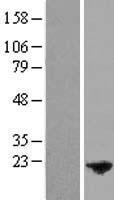 Western blot validation of overexpression lysate (Cat# LY405742) using anti-DDK antibody (Cat# TA50011-100). Left: Cell lysates from un-transfected HEK293T cells; Right: Cell lysates from HEK293T cells transfected with RC211569 using transfection reagent MegaTran 2.0 (Cat# TT210002).