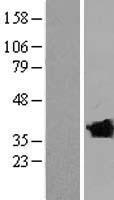 Western blot validation of overexpression lysate (Cat# LY423183) using anti-DDK antibody (Cat# TA50011-100). Left: Cell lysates from un-transfected HEK293T cells; Right: Cell lysates from HEK293T cells transfected with RC219317 using transfection reagent MegaTran 2.0 (Cat# TT210002).