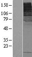 Western blot validation of overexpression lysate (Cat# LY407803) using anti-DDK antibody (Cat# TA50011-100). Left: Cell lysates from un-transfected HEK293T cells; Right: Cell lysates from HEK293T cells transfected with RC217620 using transfection reagent MegaTran 2.0 (Cat# TT210002).