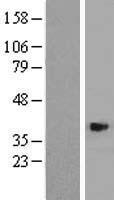 Western blot validation of overexpression lysate (Cat# LY407825) using anti-DDK antibody (Cat# TA50011-100). Left: Cell lysates from un-transfected HEK293T cells; Right: Cell lysates from HEK293T cells transfected with RC224451 using transfection reagent MegaTran 2.0 (Cat# TT210002).