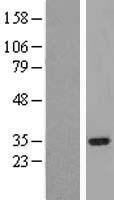 Western blot validation of overexpression lysate (Cat# LY423178) using anti-DDK antibody (Cat# TA50011-100). Left: Cell lysates from un-transfected HEK293T cells; Right: Cell lysates from HEK293T cells transfected with RC221020 using transfection reagent MegaTran 2.0 (Cat# TT210002).