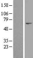 Western blot validation of overexpression lysate (Cat# LY406494) using anti-DDK antibody (Cat# TA50011-100). Left: Cell lysates from un-transfected HEK293T cells; Right: Cell lysates from HEK293T cells transfected with RC217274 using transfection reagent MegaTran 2.0 (Cat# TT210002).