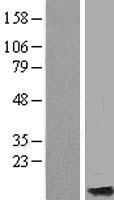 Western blot validation of overexpression lysate (Cat# LY409877) using anti-DDK antibody (Cat# TA50011-100). Left: Cell lysates from un-transfected HEK293T cells; Right: Cell lysates from HEK293T cells transfected with RC214104 using transfection reagent MegaTran 2.0 (Cat# TT210002).