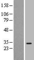Western blot validation of overexpression lysate (Cat# LY407190) using anti-DDK antibody (Cat# TA50011-100). Left: Cell lysates from un-transfected HEK293T cells; Right: Cell lysates from HEK293T cells transfected with RC216804 using transfection reagent MegaTran 2.0 (Cat# TT210002).