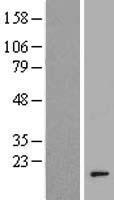 Western blot validation of overexpression lysate (Cat# LY407560) using anti-DDK antibody (Cat# TA50011-100). Left: Cell lysates from un-transfected HEK293T cells; Right: Cell lysates from HEK293T cells transfected with RC213490 using transfection reagent MegaTran 2.0 (Cat# TT210002).