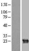 Western blot validation of overexpression lysate (Cat# LY417447) using anti-DDK antibody (Cat# TA50011-100). Left: Cell lysates from un-transfected HEK293T cells; Right: Cell lysates from HEK293T cells transfected with RC214533 using transfection reagent MegaTran 2.0 (Cat# TT210002).