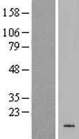 Western blot validation of overexpression lysate (Cat# LY405720) using anti-DDK antibody (Cat# TA50011-100). Left: Cell lysates from un-transfected HEK293T cells; Right: Cell lysates from HEK293T cells transfected with RC224546 using transfection reagent MegaTran 2.0 (Cat# TT210002).