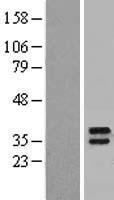 Western blot validation of overexpression lysate (Cat# LY413722) using anti-DDK antibody (Cat# TA50011-100). Left: Cell lysates from un-transfected HEK293T cells; Right: Cell lysates from HEK293T cells transfected with RC212498 using transfection reagent MegaTran 2.0 (Cat# TT210002).