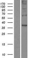 Western blot validation of overexpression lysate (Cat# LY406139) using anti-DDK antibody (Cat# TA50011-100). Left: Cell lysates from un-transfected HEK293T cells; Right: Cell lysates from HEK293T cells transfected with RC223842 using transfection reagent MegaTran 2.0 (Cat# TT210002).