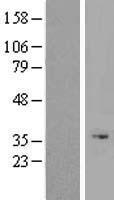 Western blot validation of overexpression lysate (Cat# LY405890) using anti-DDK antibody (Cat# TA50011-100). Left: Cell lysates from un-transfected HEK293T cells; Right: Cell lysates from HEK293T cells transfected with RC218037 using transfection reagent MegaTran 2.0 (Cat# TT210002).