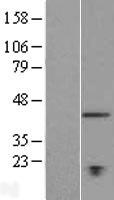 Western blot validation of overexpression lysate (Cat# LY414684) using anti-DDK antibody (Cat# TA50011-100). Left: Cell lysates from un-transfected HEK293T cells; Right: Cell lysates from HEK293T cells transfected with RC214148 using transfection reagent MegaTran 2.0 (Cat# TT210002).