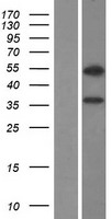 Western blot validation of overexpression lysate (Cat# LY407445) using anti-DDK antibody (Cat# TA50011-100). Left: Cell lysates from un-transfected HEK293T cells; Right: Cell lysates from HEK293T cells transfected with RC222794 using transfection reagent MegaTran 2.0 (Cat# TT210002).
