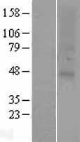 Western blot validation of overexpression lysate (Cat# LY415814) using anti-DDK antibody (Cat# TA50011-100). Left: Cell lysates from un-transfected HEK293T cells; Right: Cell lysates from HEK293T cells transfected with RC213938 using transfection reagent MegaTran 2.0 (Cat# TT210002).