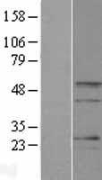 Western blot validation of overexpression lysate (Cat# LY412652) using anti-DDK antibody (Cat# TA50011-100). Left: Cell lysates from un-transfected HEK293T cells; Right: Cell lysates from HEK293T cells transfected with RC217326 using transfection reagent MegaTran 2.0 (Cat# TT210002).