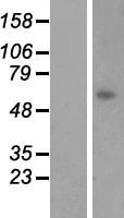 Western blot validation of overexpression lysate (Cat# LY413894) using anti-DDK antibody (Cat# TA50011-100). Left: Cell lysates from un-transfected HEK293T cells; Right: Cell lysates from HEK293T cells transfected with RC220287 using transfection reagent MegaTran 2.0 (Cat# TT210002).