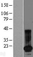 Western blot validation of overexpression lysate (Cat# LY422927) using anti-DDK antibody (Cat# TA50011-100). Left: Cell lysates from un-transfected HEK293T cells; Right: Cell lysates from HEK293T cells transfected with RC216287 using transfection reagent MegaTran 2.0 (Cat# TT210002).