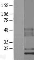 Western blot validation of overexpression lysate (Cat# LY422513) using anti-DDK antibody (Cat# TA50011-100). Left: Cell lysates from un-transfected HEK293T cells; Right: Cell lysates from HEK293T cells transfected with RC224510 using transfection reagent MegaTran 2.0 (Cat# TT210002).